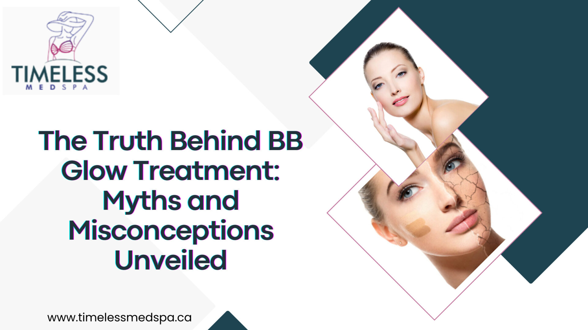 The Truth Behind BB Glow Treatment Myths and Misconceptions Unveiled